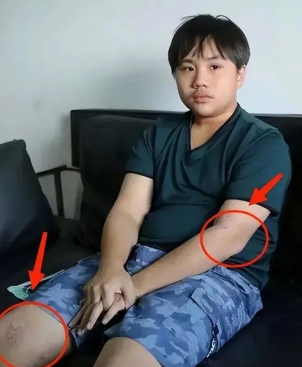 Tiểu Bân Bân bị cha coi là cỗ máy kiếm tiền khiến tuổi thơ của cậu phải làm việc vất vả, đến thời thiếu niên lại không có tiền chữa bệnh. Tiểu Bân Bân bị cha coi là cỗ máy kiếm tiền khiến tuổi thơ của cậu phải làm việc vất vả, đến thời thiếu niên lại không có tiền chữa bệnh.