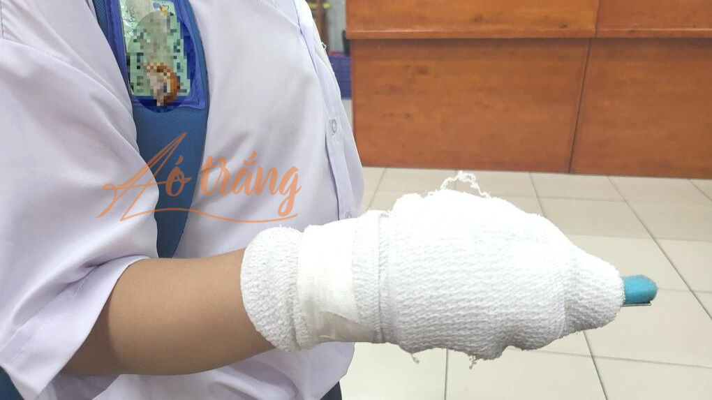 1 giáo viên bị tố đánh gãy tay học sinh.