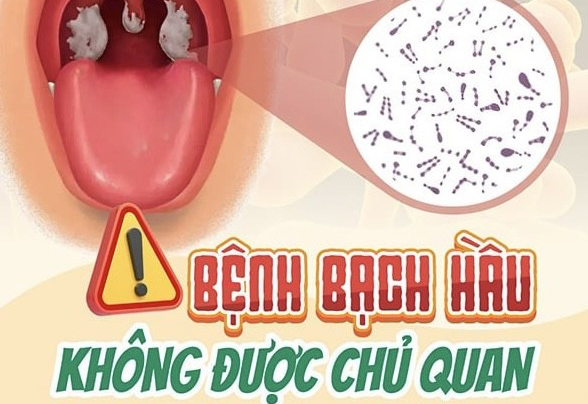 Bạch hầu là bệnh gì, nguy hiểm ra sao?