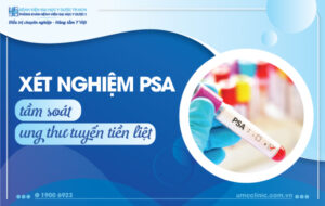 xet-nghiem-psa-tam-soat-ung-thu-tuyen-tien-liet