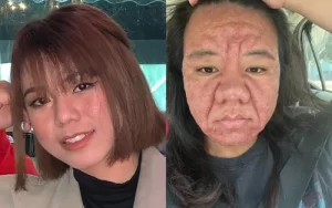 Mẹ bầu hoảng loạn vì 'biến dạng' gấp 10 lần trong thai kỳ