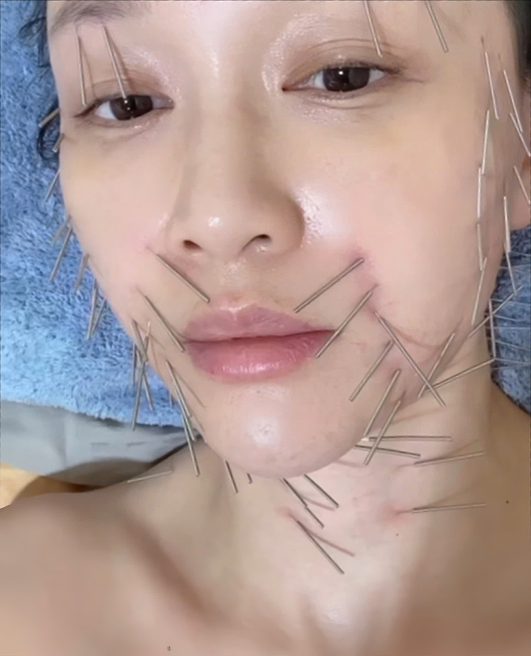 Trần Kiều Ân chọn phương pháp làm đẹp khiến ai cũng 'rợn người'