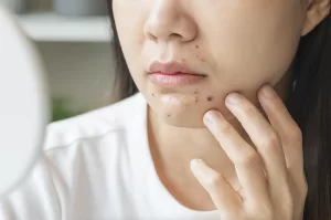 Thói quen nhỏ khi nấu ăn có thể phá hỏng quy trình chăm sóc da. Ảnh: Freepik