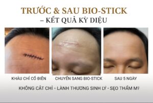 Dr. Phan Sử và ca phẫu thuật thẩm mỹ “không tưởng” bằng Bio-Stick