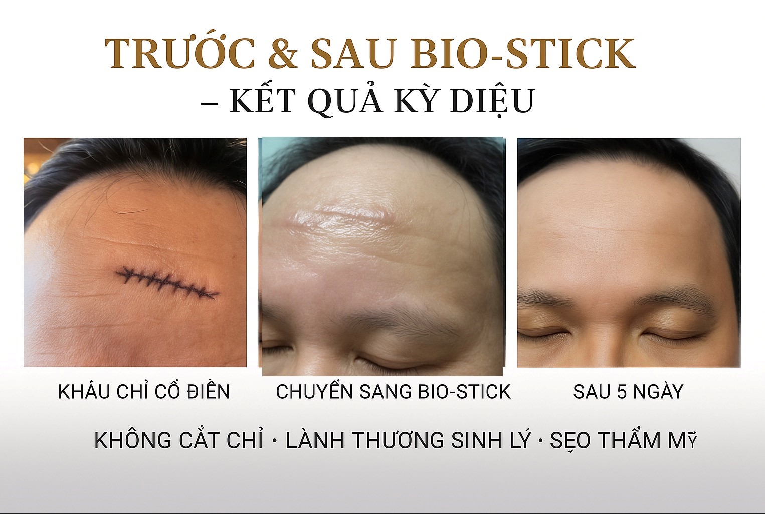 Dr. Phan Sử và ca phẫu thuật thẩm mỹ “không tưởng” bằng Bio-Stick