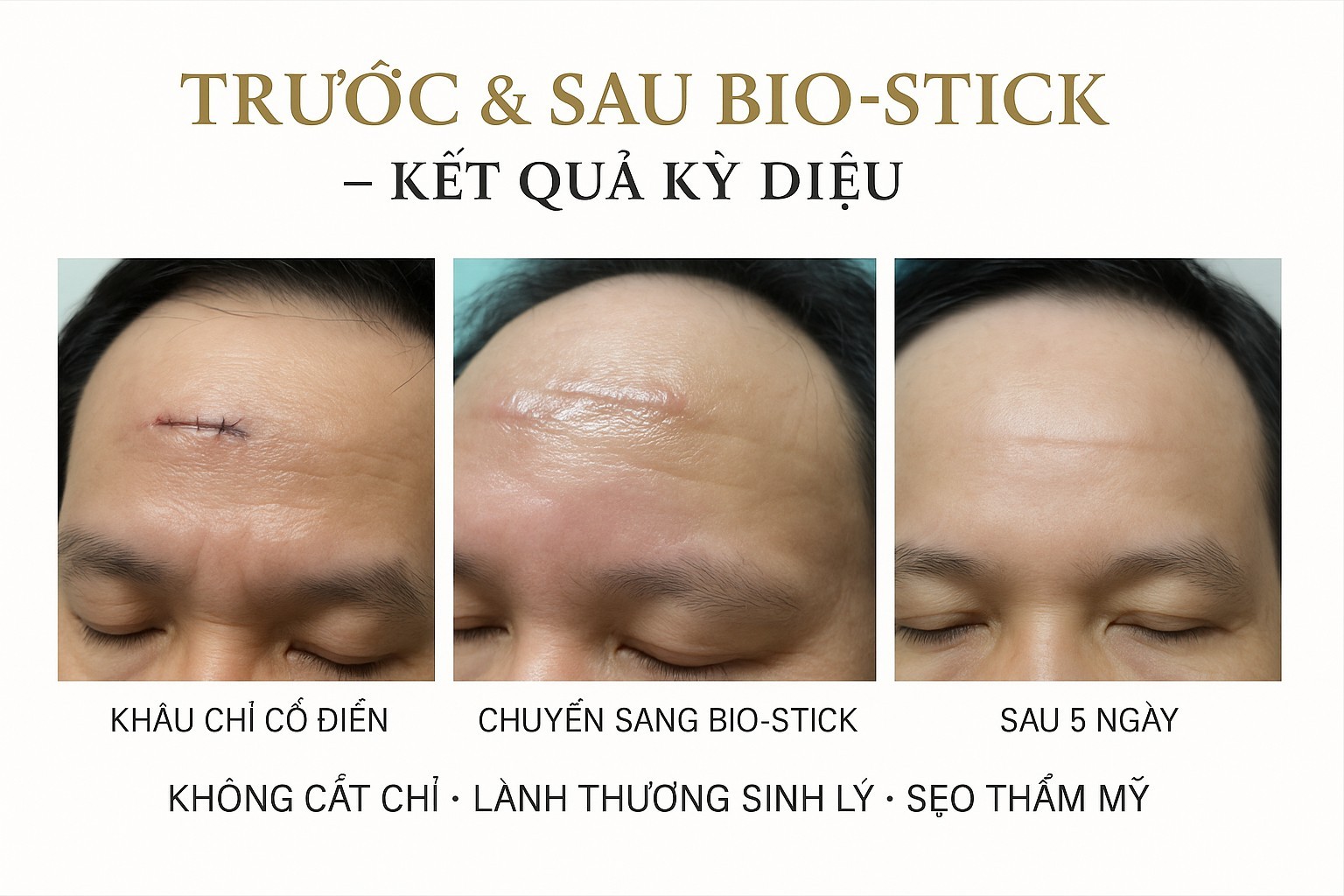 Câu chuyện Dr. Phan Sử tự mổ cho chính mình không chỉ gây sửng sốt trong giới y khoa, mà còn trở thành biểu tượng của niềm tin và đẳng cấp chuyên môn.