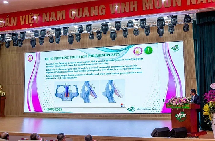 FitMe 3D – Khi công nghệ in 3D thay đổi cuộc chơi trong phẫu thuật nâng mũi