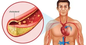 Ăn tôm có làm tăng cholesterol? Điều cần biết để bảo vệ sức khỏe tim mạch.