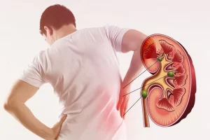 Hơn 10 triệu người Việt mắc bệnh thận: Dấu hiệu cảnh báo cần biết
